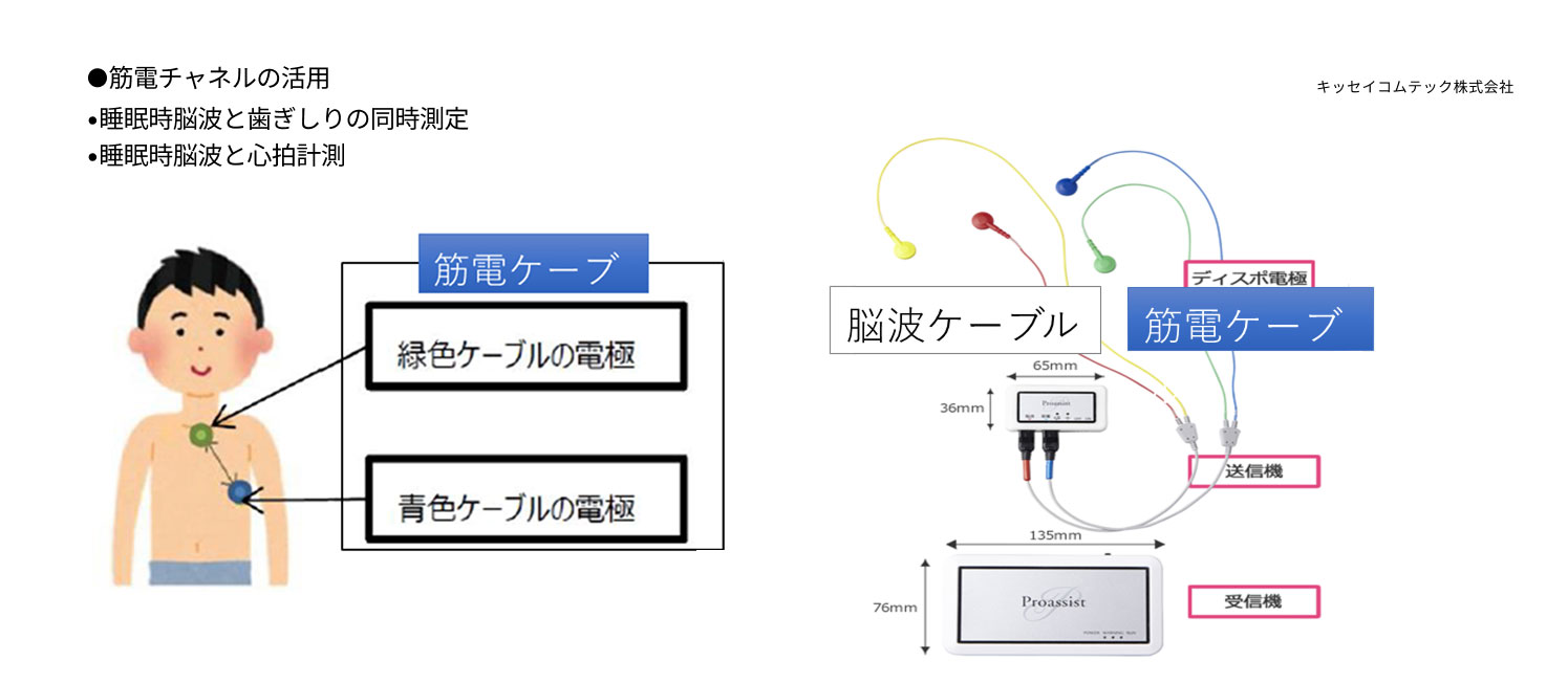 睡眠学会認定技師による解析