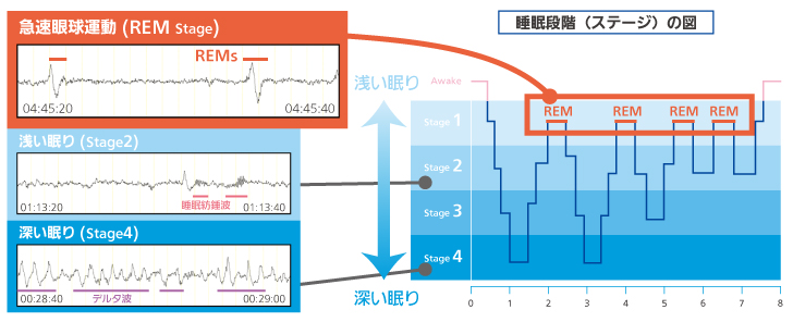 収録できる特徴的な睡眠脳波